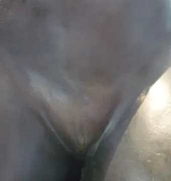 Detail of Diana’s bronze sculpture at the Louvre with damage to the lower body.
